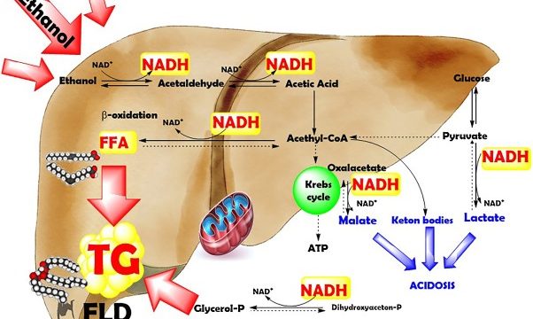 GLP-1 Effects on Non-Alcoholic Fatty Liver Disease (NAFLD)