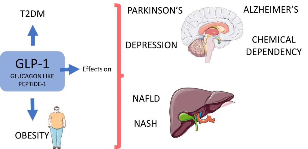 GLP-1's Role in Alzheimer's and Parkinson's Treatment