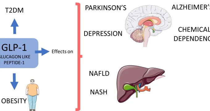 GLP-1's Role in Alzheimer's and Parkinson's Treatment